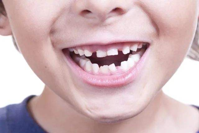 怎么保护孩子的牙齿