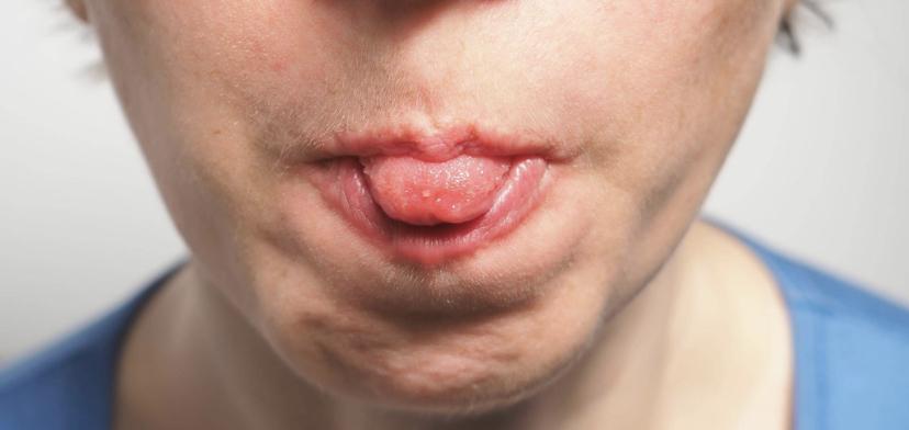 舌苔发黄是什么原因