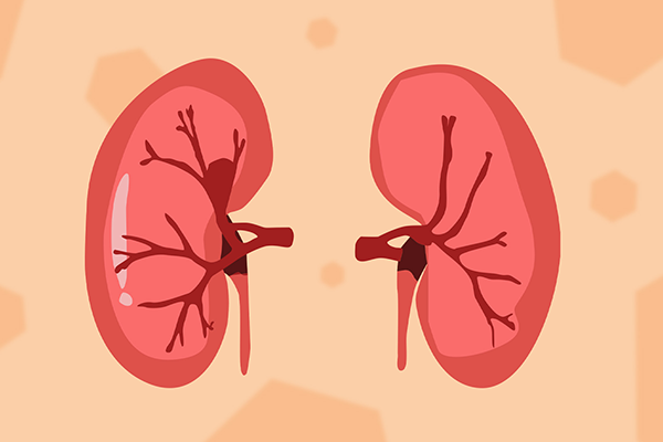 肾囊肿饮食要注意什么 肾囊肿饮食注意事项