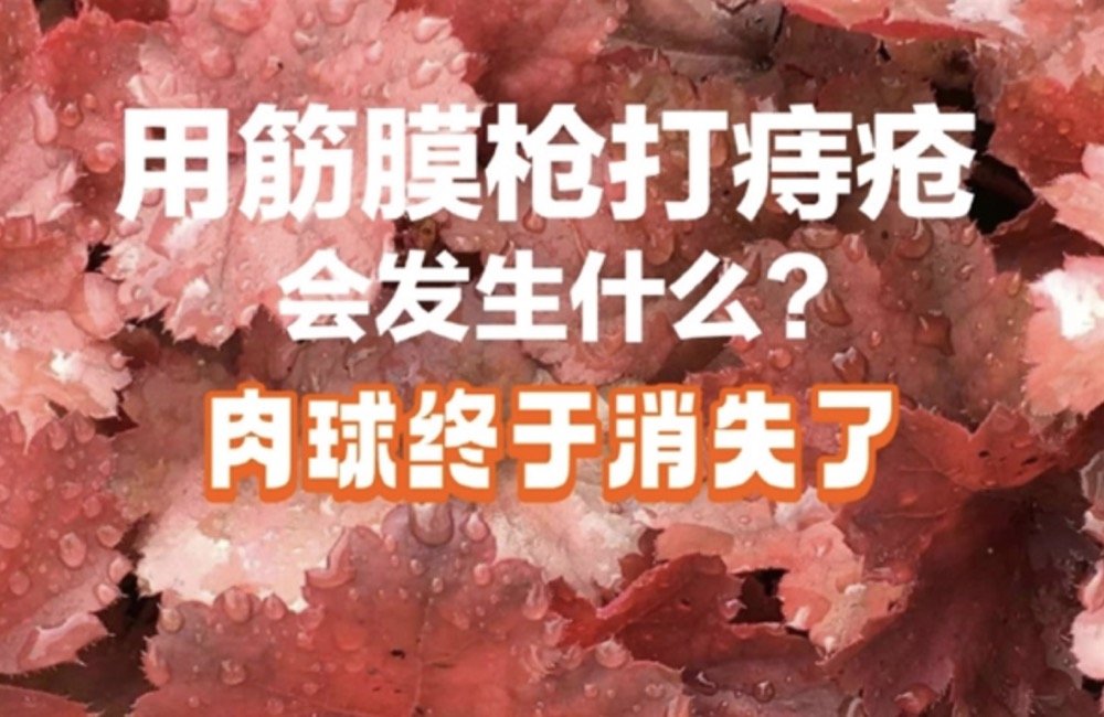 筋膜枪可以治痔疮?透视“筋膜枪治疗痔疮”谣言